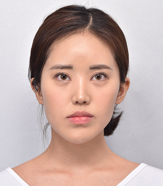 ใบหน้าก่อนผ่าตัด
